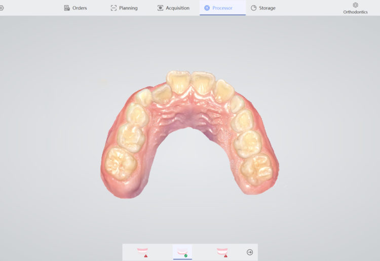 3D Dental Scanning: The Modern Standard of Precision and Comfort
